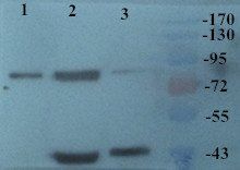 SEMA3A antibody