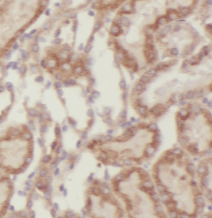 Semenogelin-1 antibody