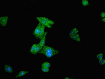 SENP2 antibody