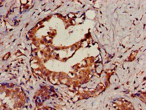 SENP2 Antibody