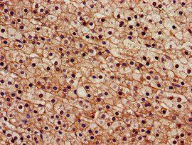 SENP2 Antibody