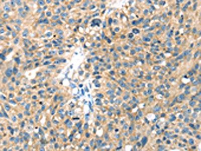 SENP8 antibody