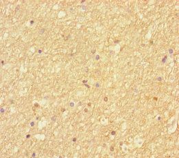 SEPT2 Antibody