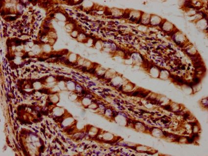 SEPT11 Antibody