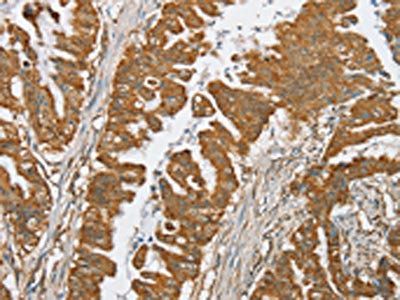 SERINC2 Antibody
