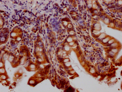 HTT Recombinant Monoclonal Antibody