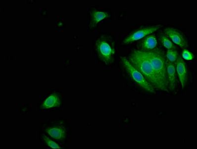 SERPINB3 Antibody