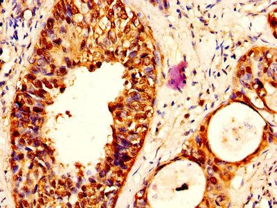 SERPINB3 Antibody