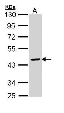 ATP6V0A2 antibody [N2C1], Internal