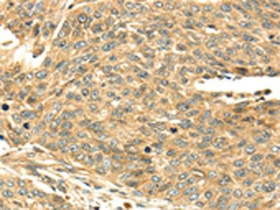 SERPINA12 Antibody