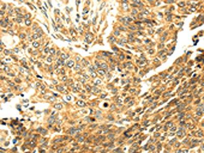 SERPINA12 Antibody