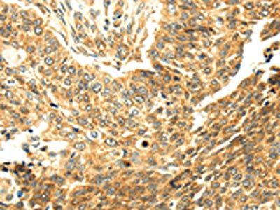 SERPINA12 antibody