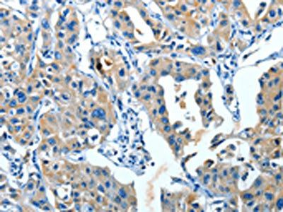 SERPINA3 Antibody