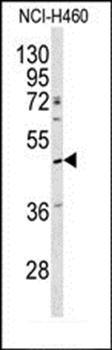 SERPINA4 antibody