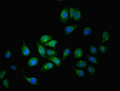 SERPINA6 Antibody