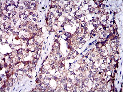 SERPINA7 Antibody