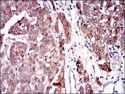 SERPINA7 Antibody