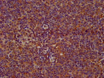 SERPINB12 antibody