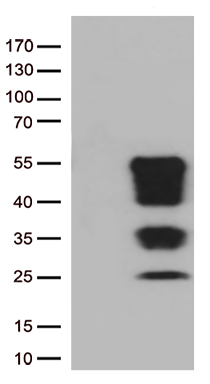 SERPINB3 Antibody