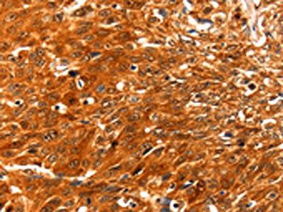 SERPINB5 Antibody