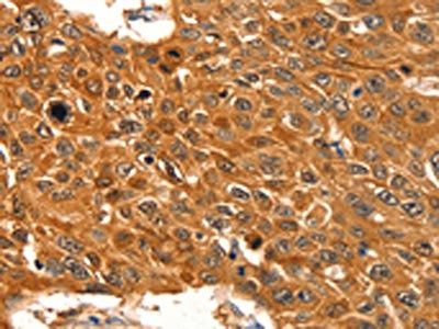 SERPINB5 Antibody