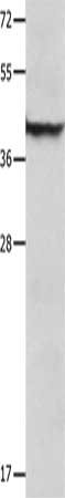 SERPINB5 antibody