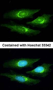 SERPINB6 antibody