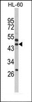 SERPINB7 antibody