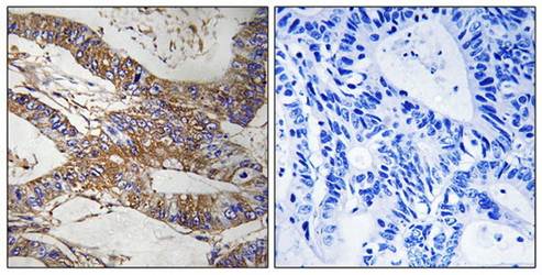 SERPINB9 Antibody