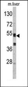SERPINC1 antibody