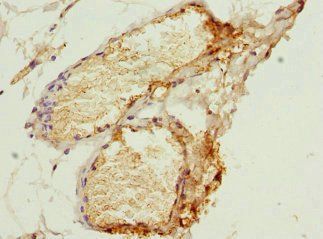 SERPIND1 antibody