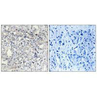 SERPIND1 Antibody