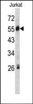 SERPING1 antibody