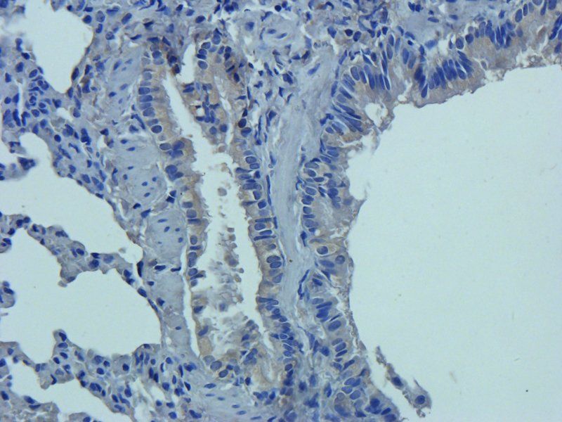 SERPING1 antibody