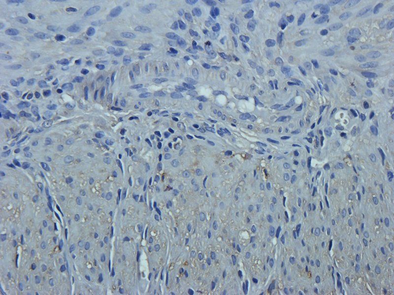 SERPING1 antibody