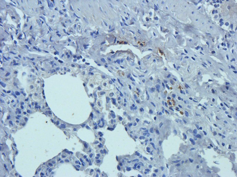 SERPING1 antibody