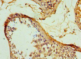 SERPINH1 Antibody
