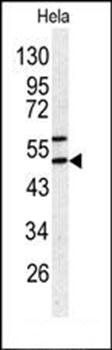 SERPINH1 antibody