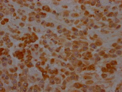 SERPINH1 Recombinant Monoclonal Antibody