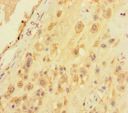 Seryl-tRNA synthetase, cytoplasmic antibody