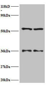Seryl-tRNA synthetase, cytoplasmic antibody