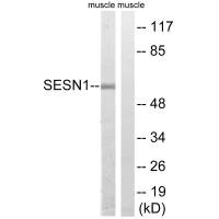 SESN1 antibody