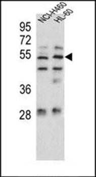 Sestrin-1 antibody