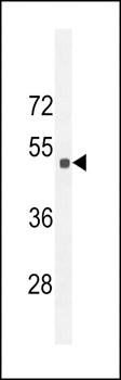 Sestrin-2 antibody