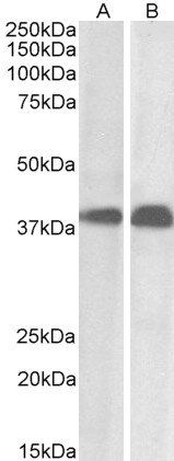 Goat anti-SET / I2 alpha PP2A Antibody