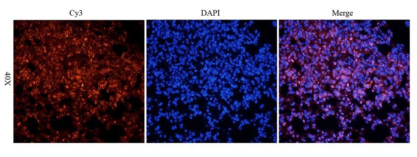 SET antibody