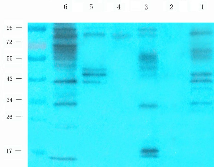 SET antibody