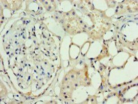 Set1/Ash2 histone methyltransferase complex subunit ASH2 antibody