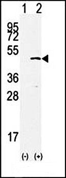 SET7 antibody