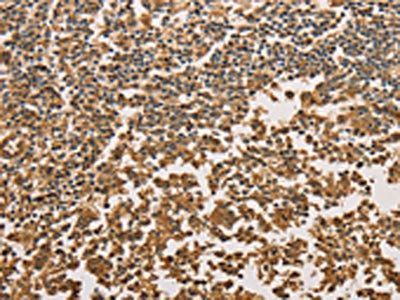 SETD2 Antibody